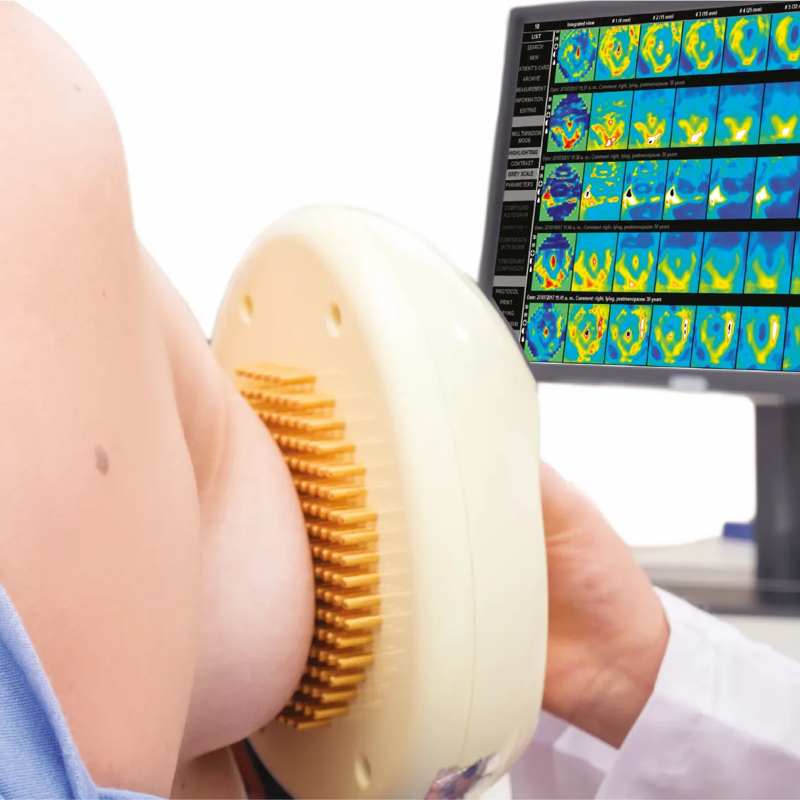 Estudio clínico de mastografía por electroimpedancia mamaria con equipo portátil MEIK y mapeo en tiempo real